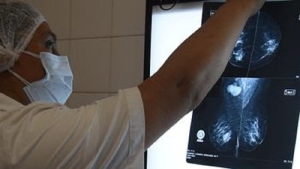 C&aacute;ncer de mama: con diagn&oacute;stico temprano la sobrevida alcanza al 90% de los casos