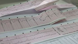 En dos meses, la Red IAM duplic&oacute; la respuesta a personas con infarto