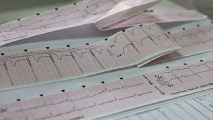 En dos meses, la Red IAM duplic&oacute; la respuesta a personas con infarto