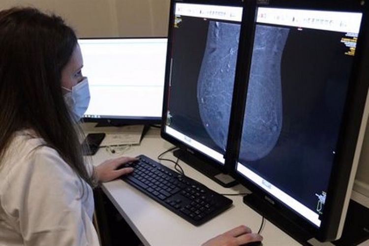 ISJ. Extienden la vigencia de mamograf&iacute;as sin el cobro del coseguro