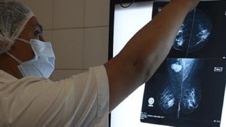 Mamograf&iacute;as en Hospital Pablo Soria se realizan tambi&eacute;n por la tarde