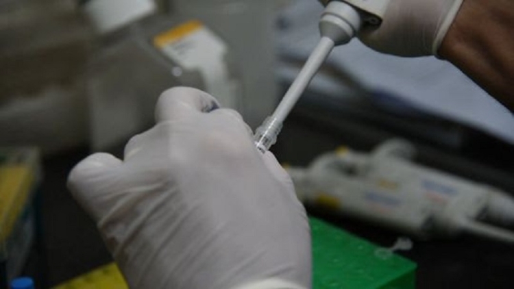 Con resultado negativo, se descart&oacute; el caso sospechoso de viruela s&iacute;mica en Jujuy
