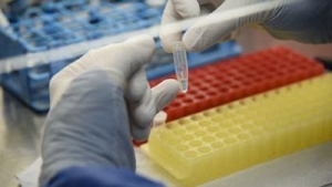 Convocatoria abierta para las Becas Salud Investiga 2022-2023
