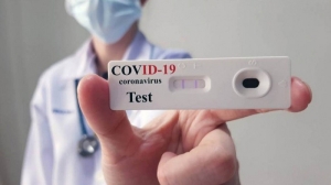 Los primeros autotest estar&iacute;an disponibles la pr&oacute;xima semana en farmacias, a 1.560 pesos